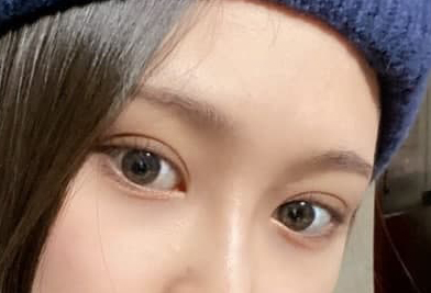 눈 붓기 잘 빠지고 있습니당ㅎㅎㅎㅎㅎ