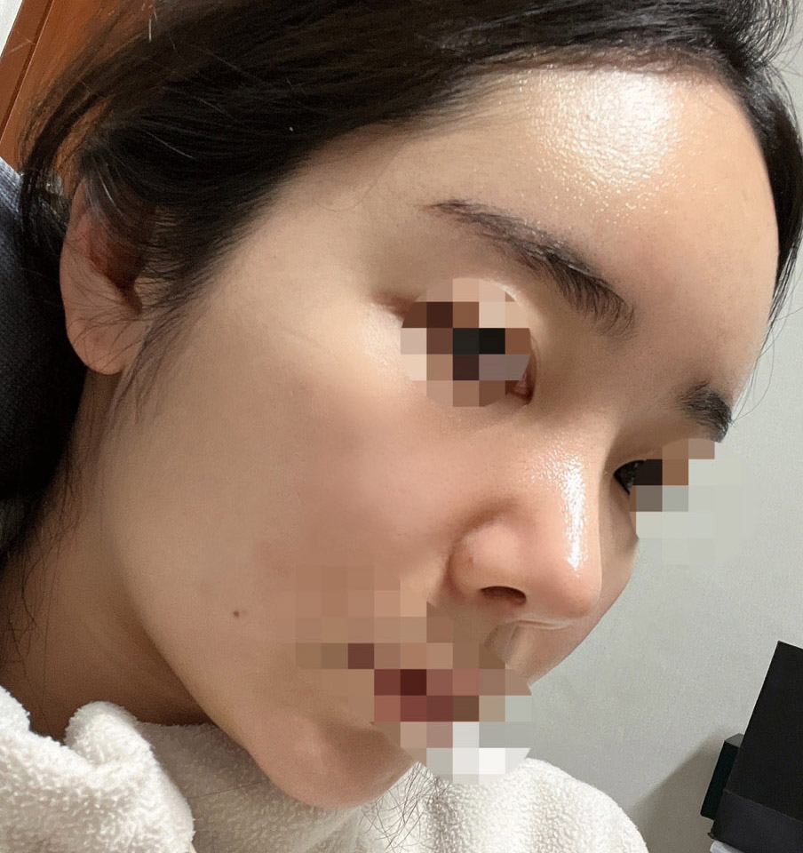 수술후_2_-1.jpg