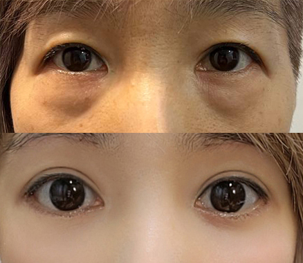 세월이 거꾸로 가는 느낌^^