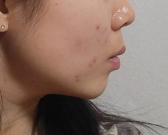 브이라인된거같아서 좋아요