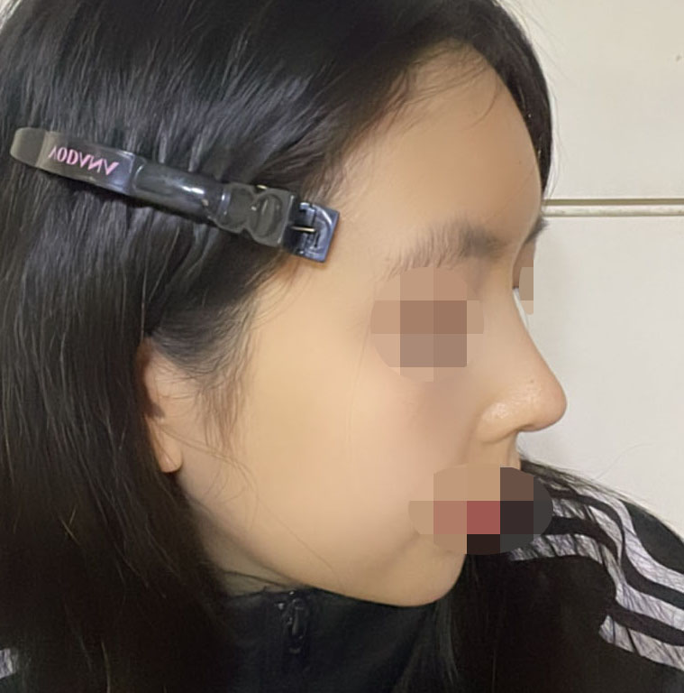 코+지이 두달차