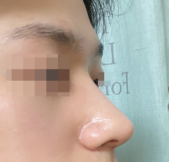 주변친구들도 잘됐다고 하네요ㅎㅎ