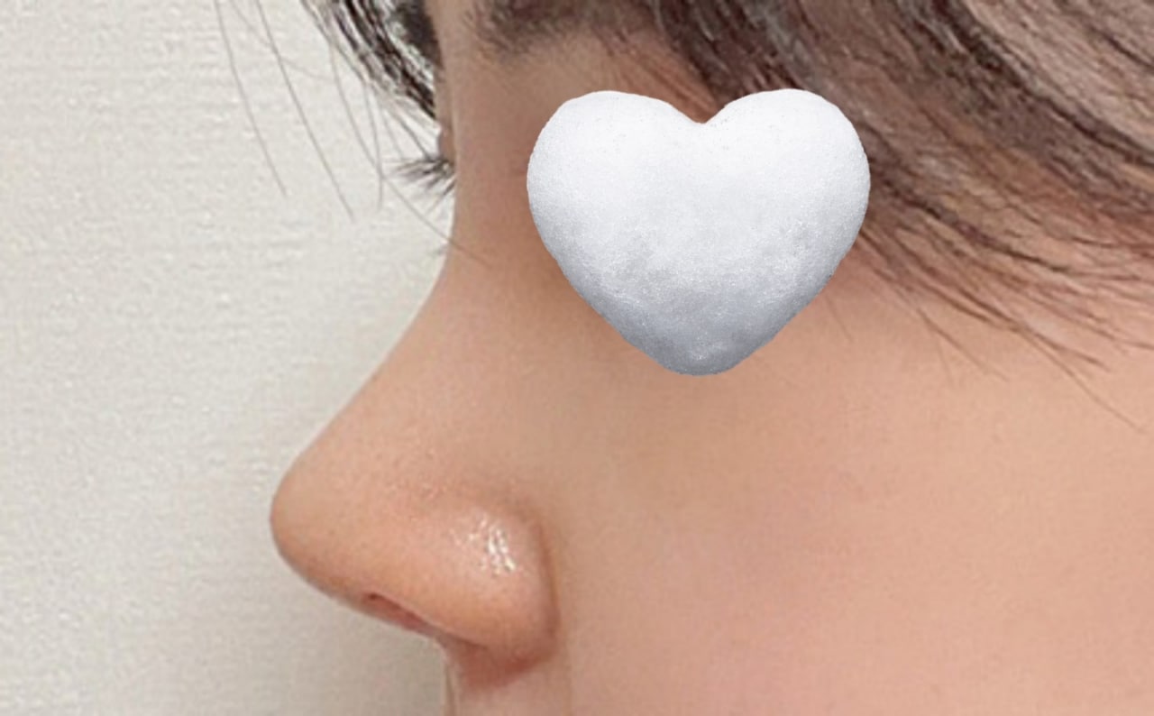 무보형물 코수술 코끝 모양이 너무 예뻐요