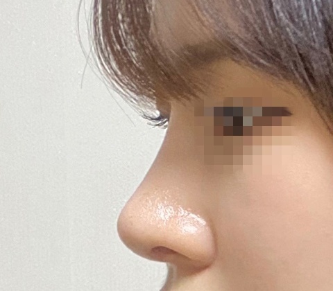 코한지 2개월됐어용