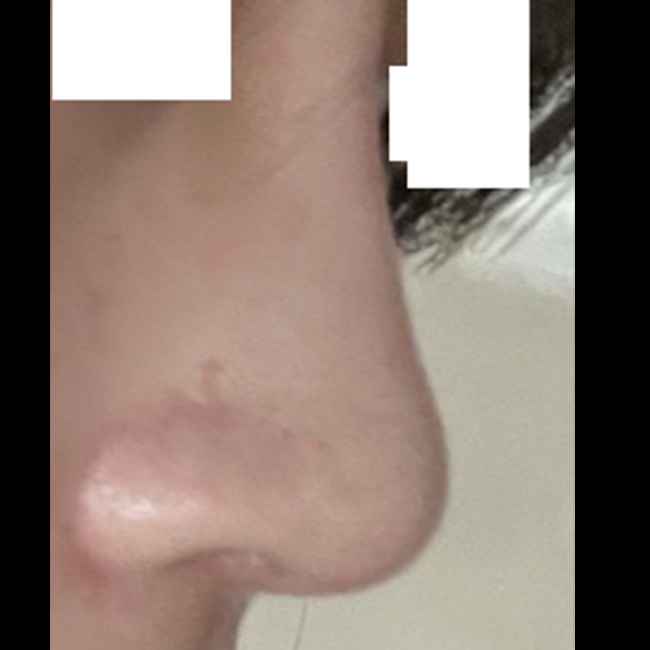 내코마냥 자연스럽게 된 후기