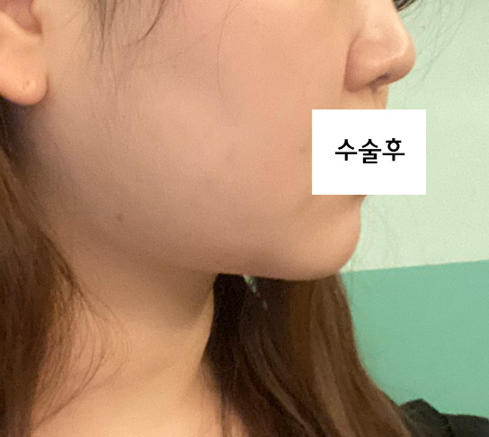 다들 친절하시고 얼지흡효과도 넘 좋아용