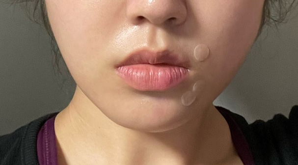 턱살 고민이면 제발하세요ㅠㅠ