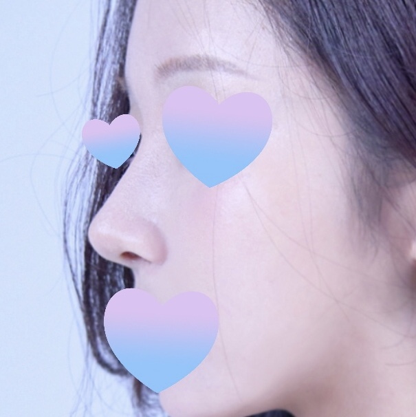 원장님께서 니즈에 맞게 딱 해주셔요!!