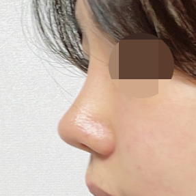 어느덧 3개월차네요>.<