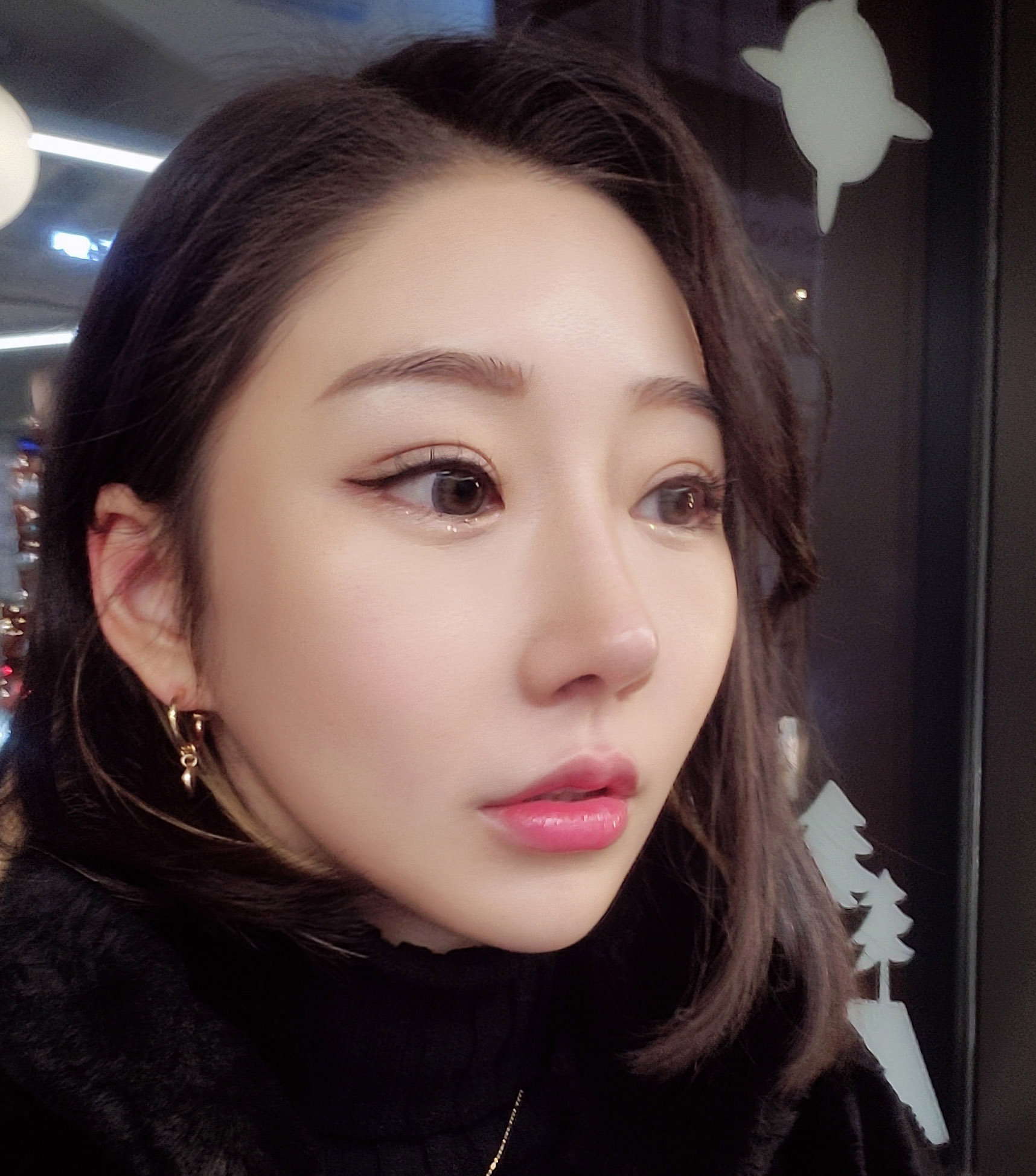 눈,코 200%만족중!! 감사합니다!(7개월차)