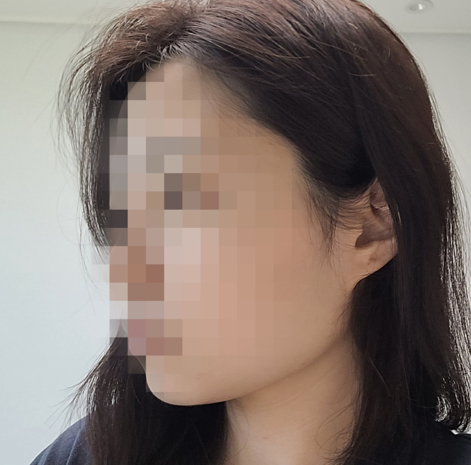 손에 잡혔던 이중턱 없어졌어요 ㅎㅎ