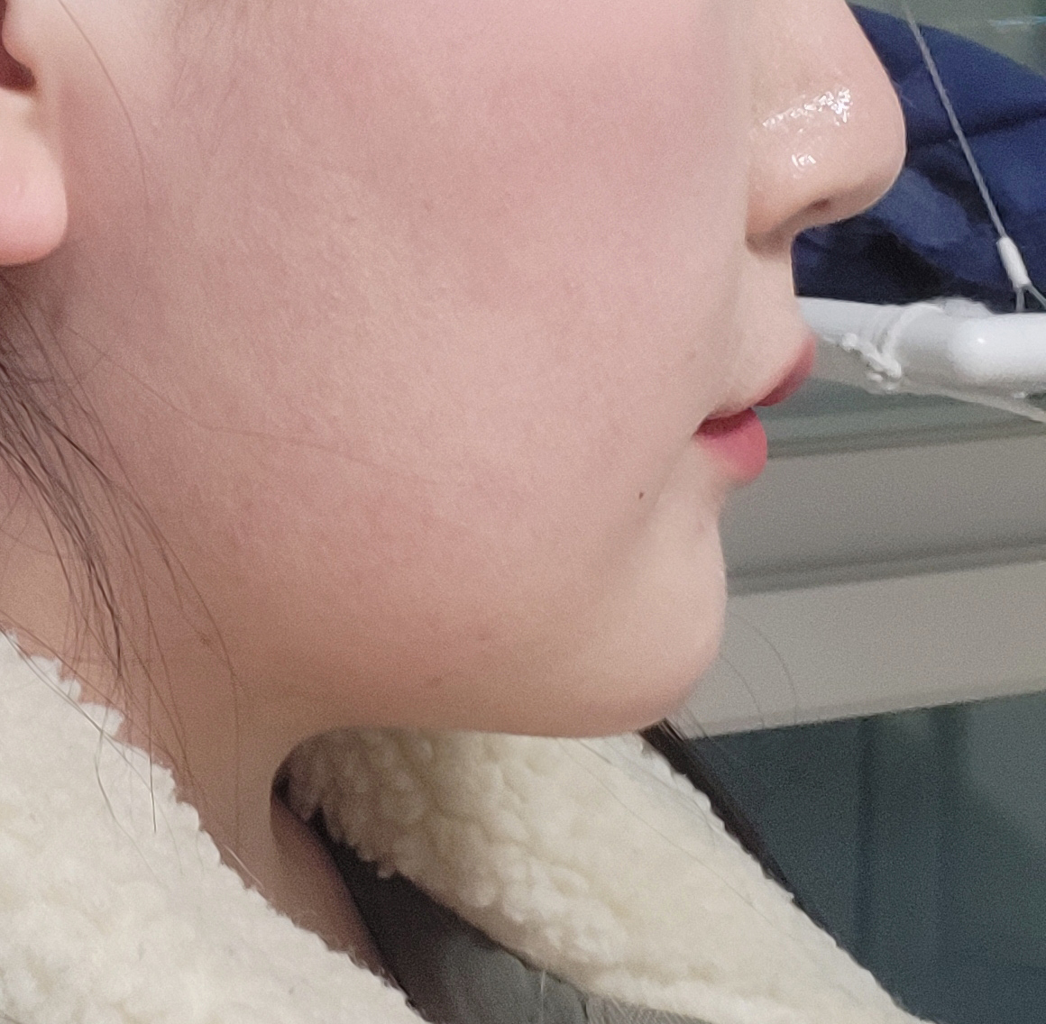 전에 있던 이중턱 순삭됐어요ㅋㅋ