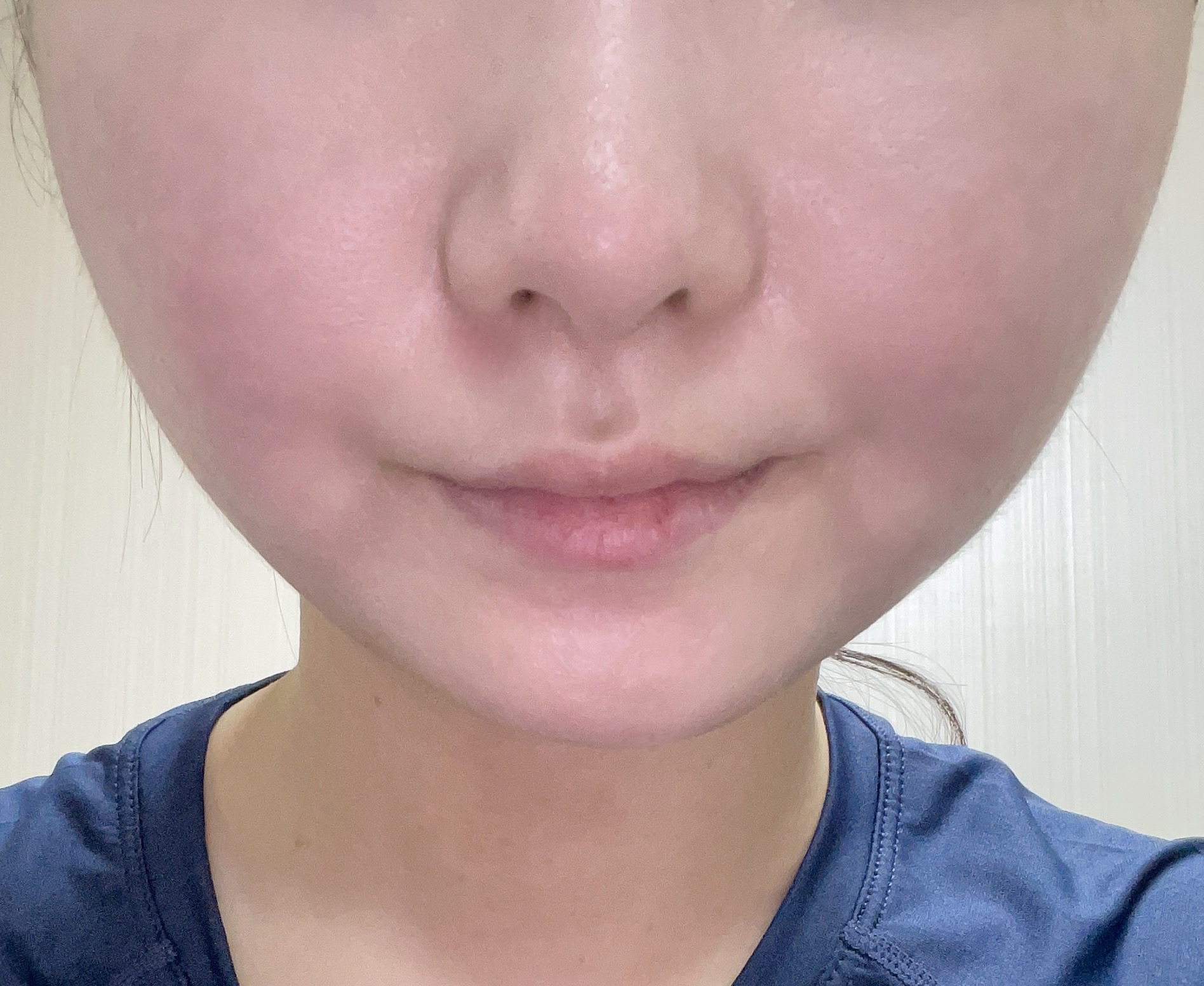 얼굴지흡 만족만족