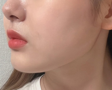 바이브 흡입 추천합니다