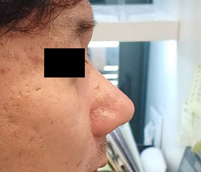 늦은 나이에 코하고 만족하며 지냅니다..