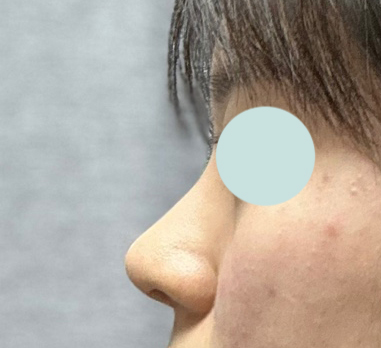 바이브에서 눈코했어용