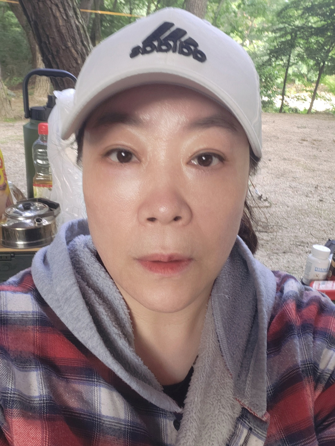 중년성형받고 동안됐어요^^