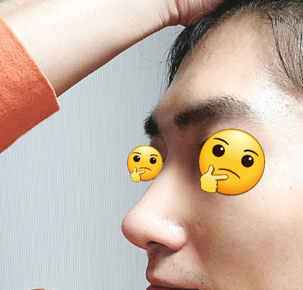 무보형물코수술 알아보시면 적극추천:)