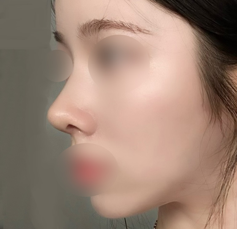 코하구 주변에서 이뻐졌대요 ㅎㅎ