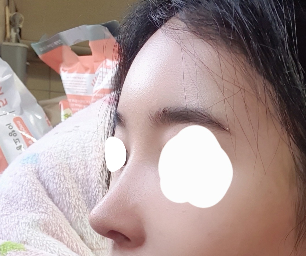 수술후_2_-1.jpg