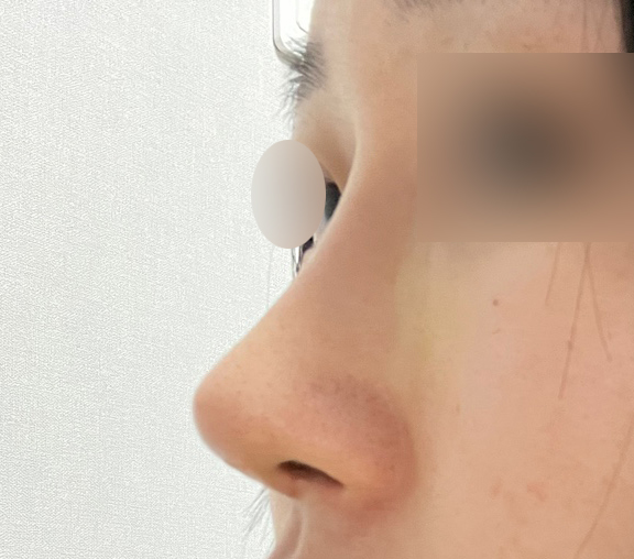 눈,코 알아보시면 상담 꼭 받아보세요!