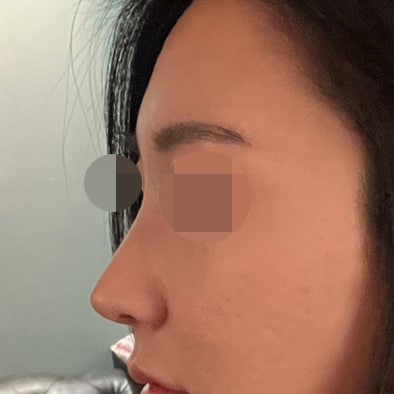 코라인 너무 예쁘게 잡아주셨어요~