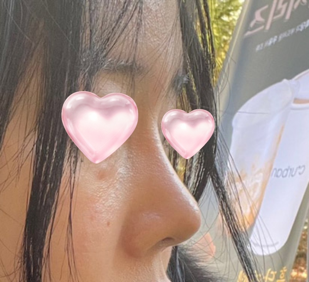 코 너무 맘에 들어용 ㅎㅎ 6개월차후기!