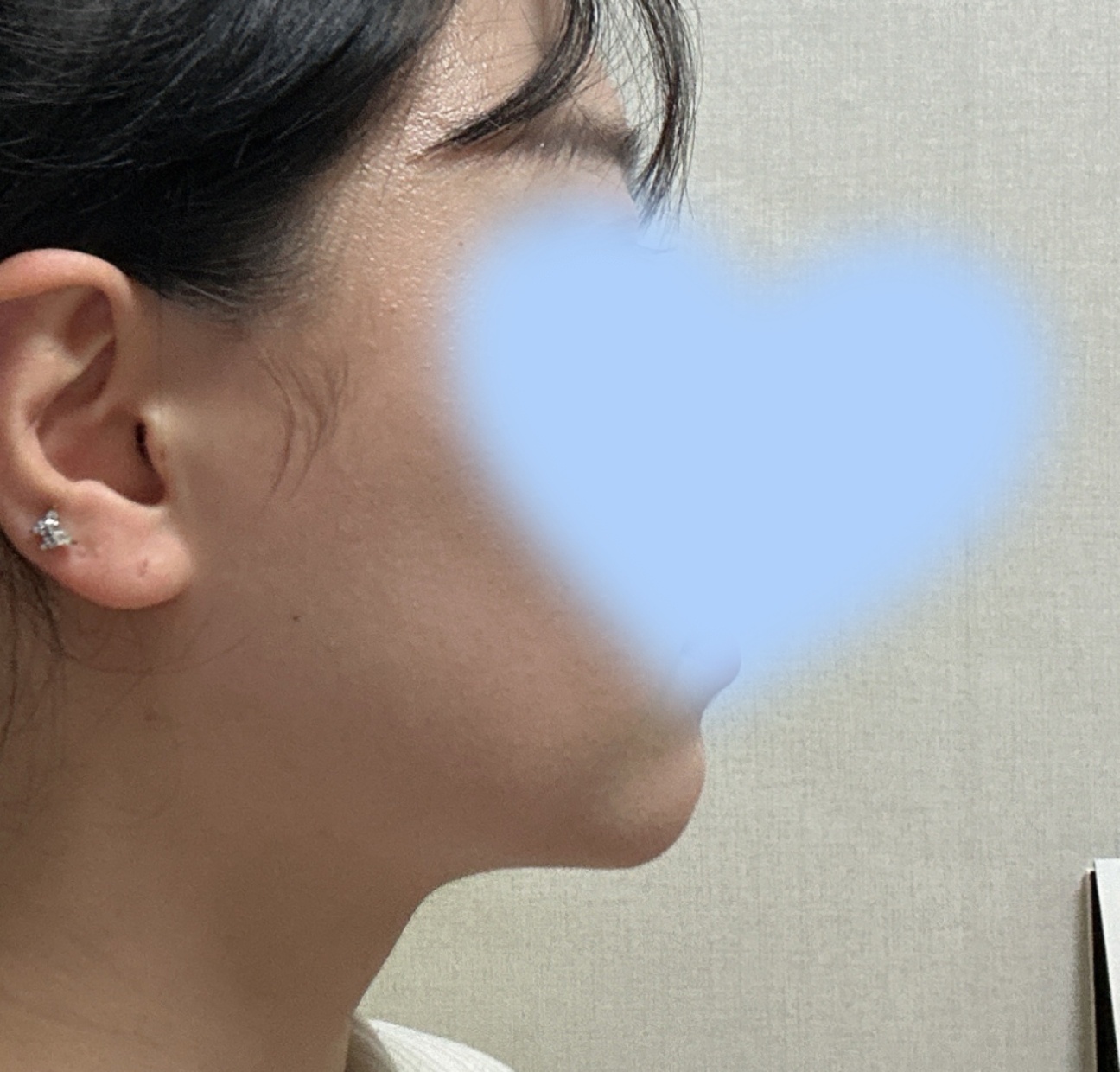 이중턱쏘옥빠지고 맘에 듭니닷 ㅎㅎ