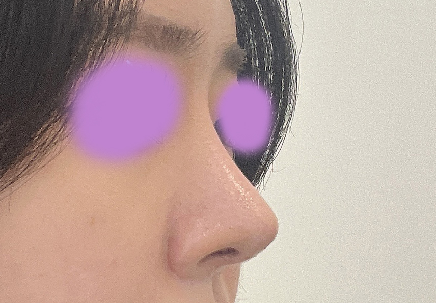 첫코 바이브에서 하길 잘한거같아용