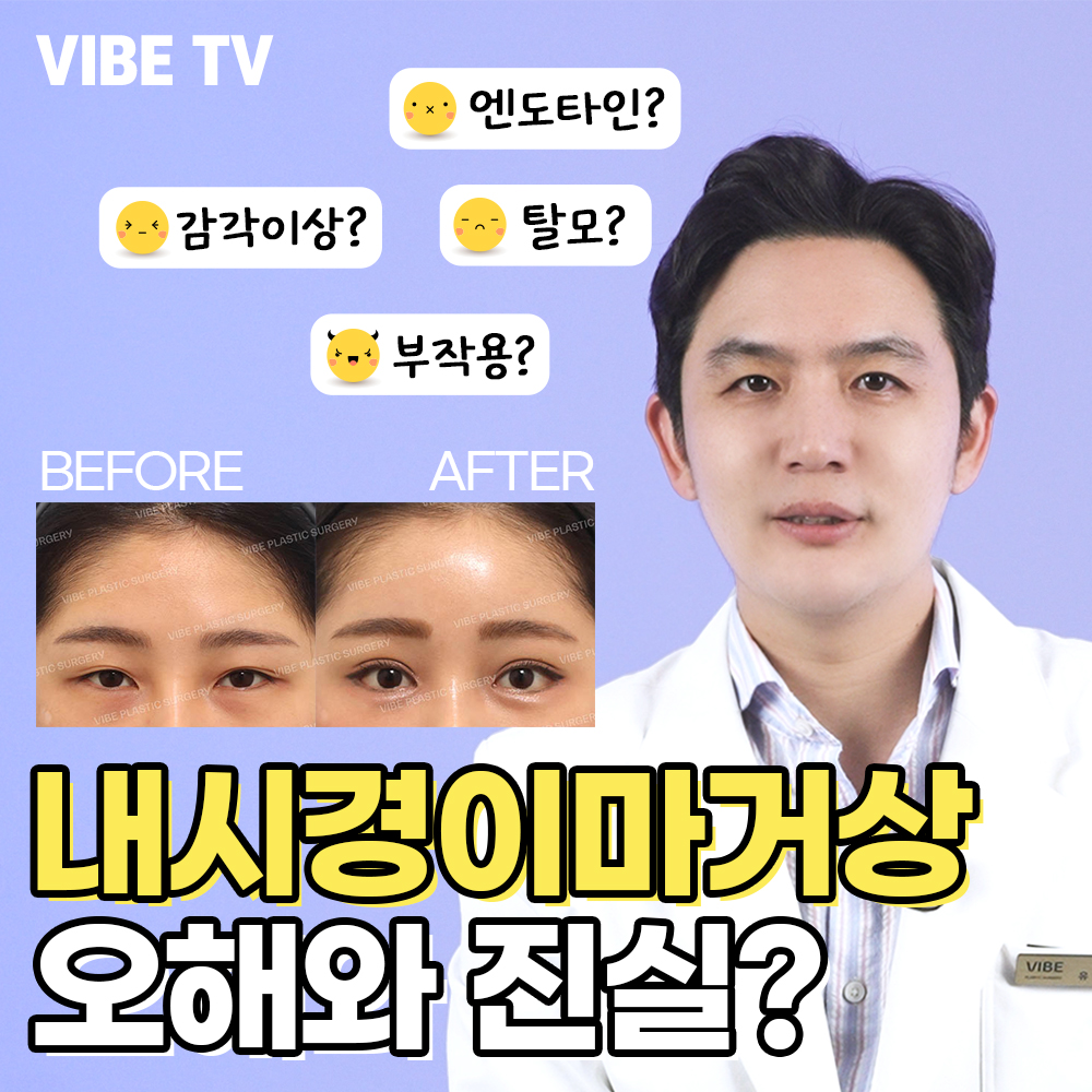 내시경이마거상 오해와 진실은~!?