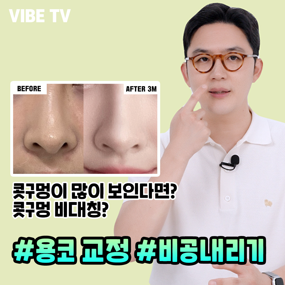 콧구멍이 많이 보이는 용코라면? 비공내리기로 해결!