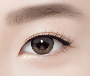 하안검성형술 Step 04