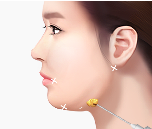 리포사운드 Step 02