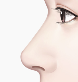 매부리코 수술 Step 04